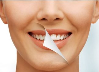 Restaurações Estéticas Restaurações estéticas