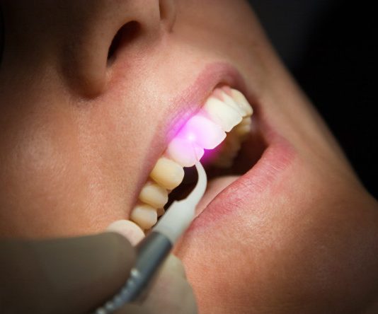 Laserterapia Laserterapia odontológica