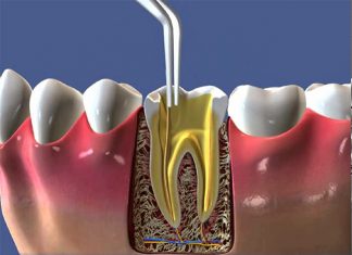 Tratamento de canal Donato e Mayhuire - Clínica Odontológica