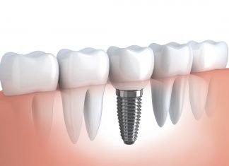 Odontologia preventiva Odontologia preventiva