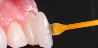 Lentes de Contato Donato e Mayhuire Clínica