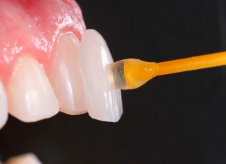 Lentes de Contato Donato e Mayhuire Clínica