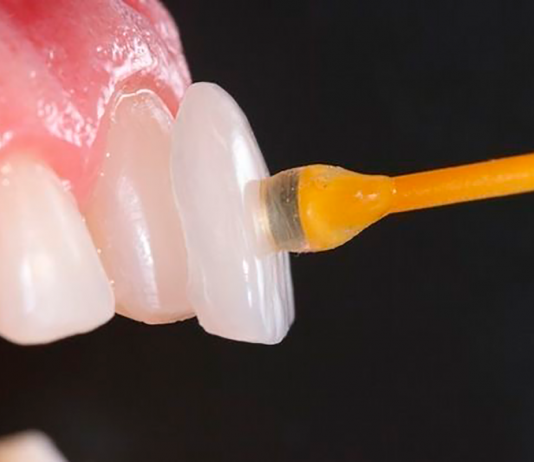 Lentes de Contato Donato e Mayhuire Clínica